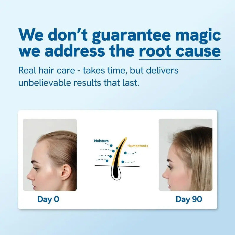 Be-Bodywise Rosemary Hair Growth Serum